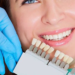 Matching a woman’s teeth for dental crown
