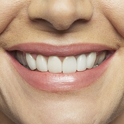 Closeup of healthy smile