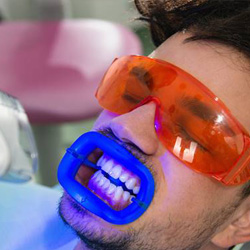 Man receiving in-office teeth whitening