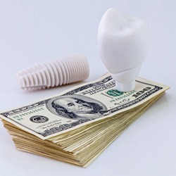 dental implant and money