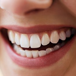 Closeup of whole healthy smile