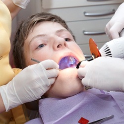 little boy getting dental sealants in Sugar Land 