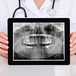 Dentist displaying panoramic x-ray on a tablet