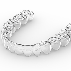A digital image of an Invisalign aligner used to improve the look and health of a person’s smile