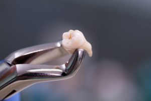 tooth in pliers