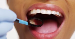 woman with mouth open dental exam