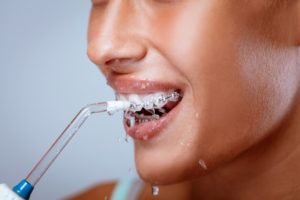 woman smiling using water flosser